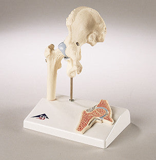 0233-Mi Functional Mini-Hip Joint Model