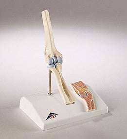 0234-Mi Functional Mini-Elbow Joint
