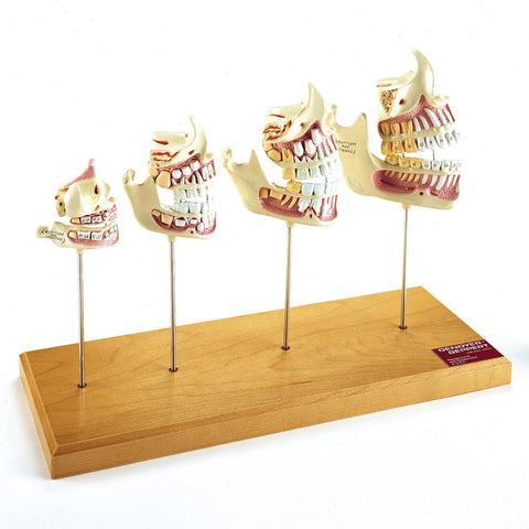 Jaw Development Model Set