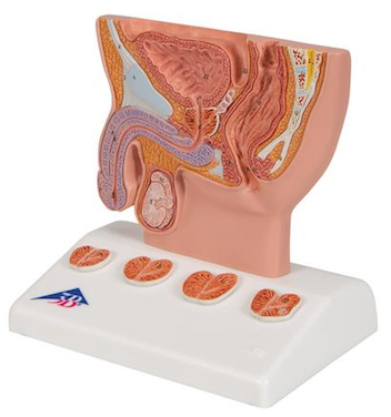 H410 Prostate Model