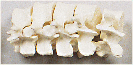 SB15-1 Lumbar Vertebrae Set (L1 through L5) - Natural Tone