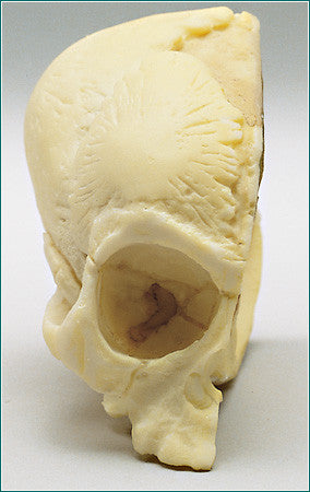 SK39 Fetal Half Skull with Dura Mater
