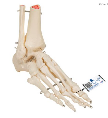 0975-31 Budget Foot, Wire mounted with Distal Tibia and Fibula