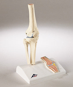 0232-Mi Functional Mini-Knee Joint Model