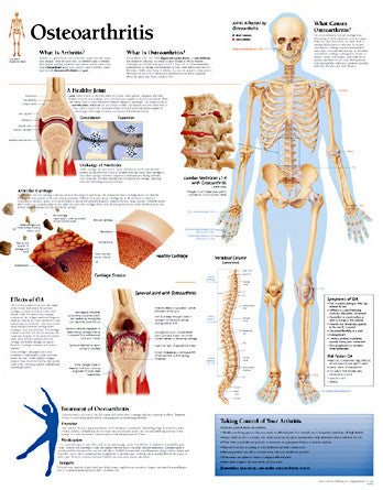 2105-08 Osteoarthritis