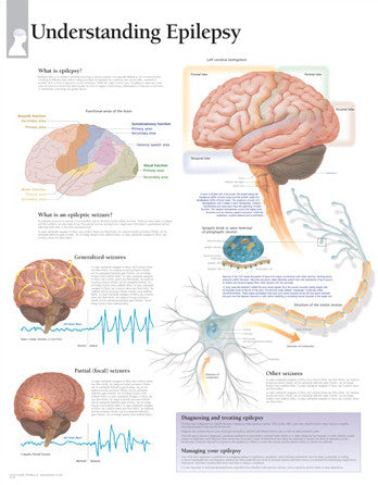 2174-08 Understanding Epilepsy