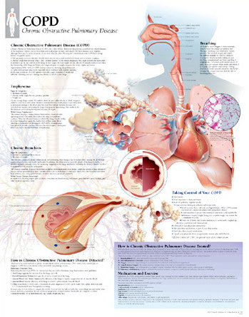 2351-08 COPD (Chronic Obstructive Pulmonary Disease)