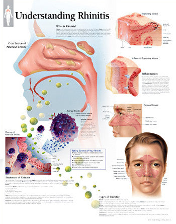 2353-08 Understanding Rhinitis