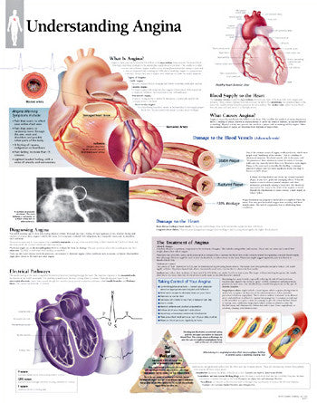 2453-08 Understanding Angina