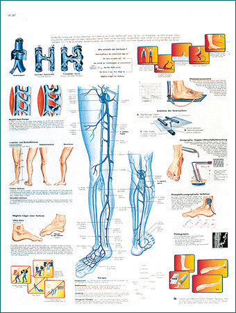 3367-08 Varicose Veins