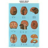 1595-01 The Brain
