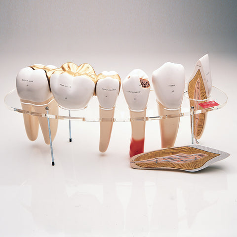 Dental Morphology - Types of Human Teeth