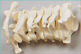 SB13-1 Cervical Vertebrae Set (C1 through C7)